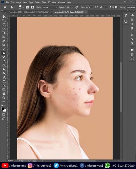 How To Remove Acne And High End Skin Retouching In Photoshop Video