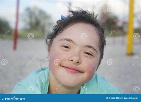Portrait Of Down Syndrome Girl Smiling On Background Of The Sea Stock