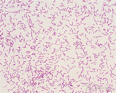 As nouns the difference between stain and safranin. Gram Stain of Escherichia coli | Flickr - Photo Sharing!
