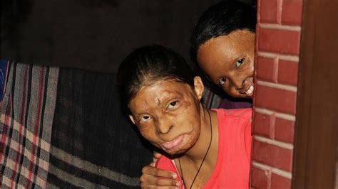 Acid Attack Victims Show Off Their True Beauty In Gorgeous New Photo Shoot Video Sheknows