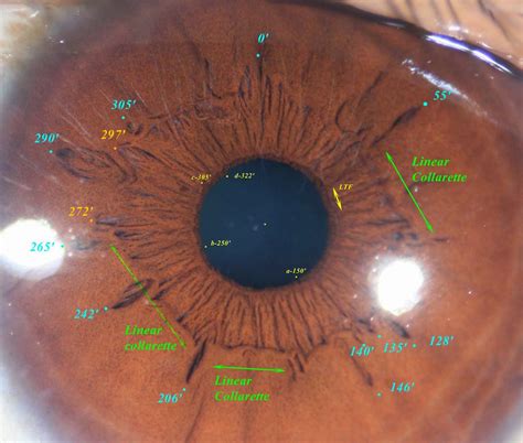 รวมกัน 91 ภาพ ขนาด Pupil ปกติ ครบถ้วน