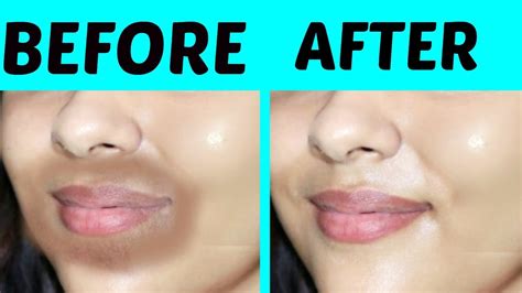 How To Get Rid Of Dark Patches Around The Lips