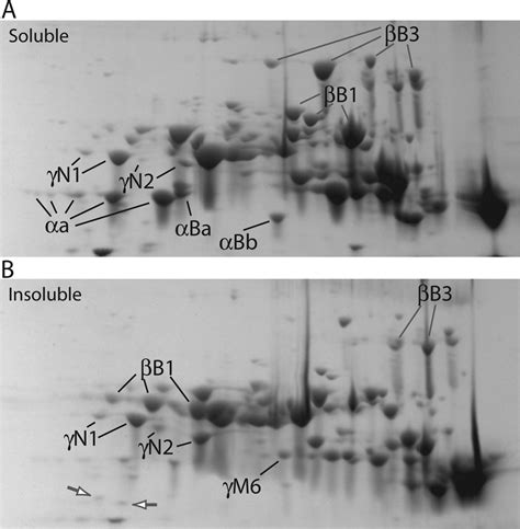 Molecular Vision Posner Mol Vis 2008 14806 814 Figure 4