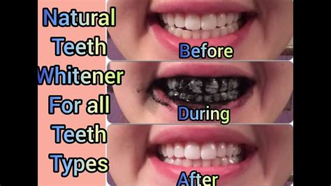 How To Whiten Teeth Naturally With Activated Charcoal At Home Youtube