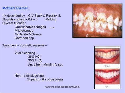 Maxillofacial Orthodontic Courses By Indian Dental Academy