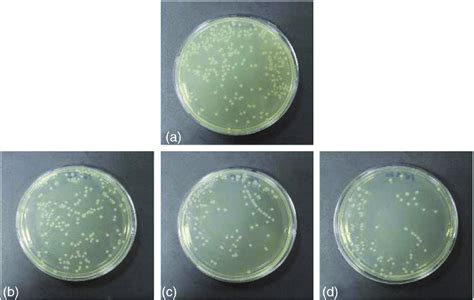 The Photographs Above Shows Nutrient Agar Plates On E Coli Containing