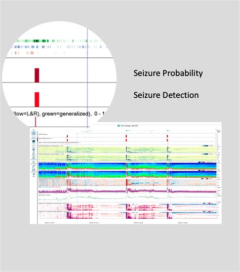 Seizure Detection Persyst