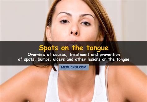 10) excessive smoking excessive smoking is the other common reason for the formation of white bumps on the tongue. Lesions on Tongue: Causes of Spots, Bumps, Swelling ...