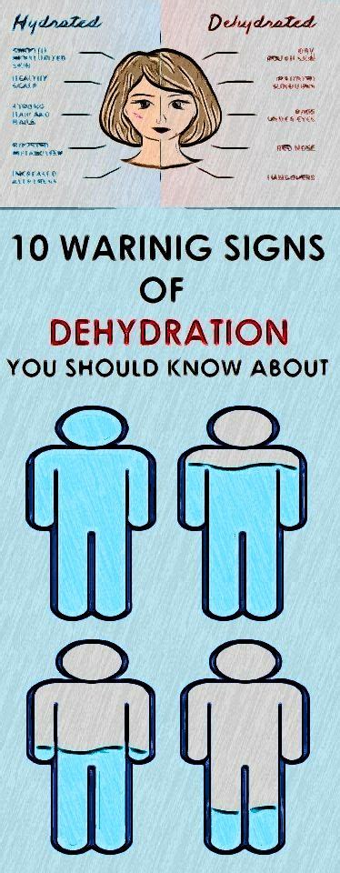10 Warning Signs Of Dehydration You Should Know About In 2020 Healthy