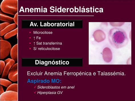 Ppt Diagnóstico Diferencial De Anemias Powerpoint Presentation Free