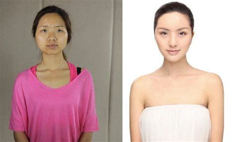 Before And After This Is What The Extreme Plastic Surgery Craze In Asia Looks Like Huffpost