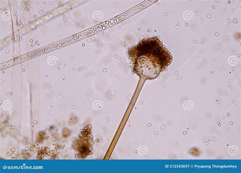 Characteristics Of Rhizopus Is A Genus Of Common Saprophytic Fungi On