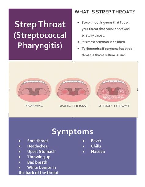 Strep Throat Booklet - Strep Throat (Streptococcal Pharyngitis) WHAT IS
