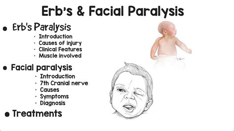 Brachial Paralysis Erbs Palsy And Facial Paralysis Bells Palsy