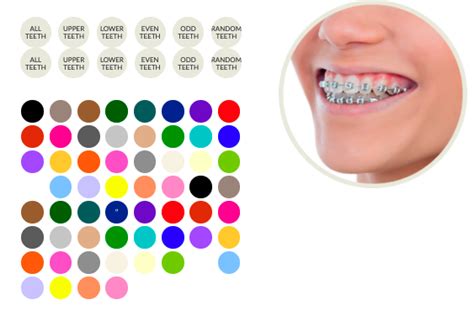 Smiles Hollywood Mckinney Orthodontist Cool Braces Colors