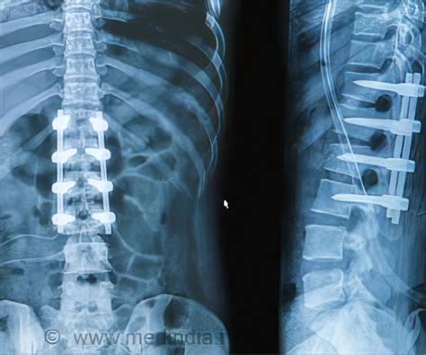 Spinal Column Anatomy