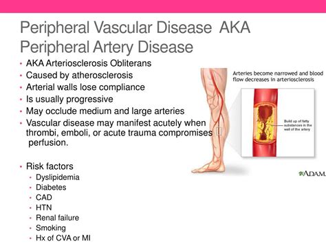 Peripheral Artery Disease Patient Education Pcna Pelajaran