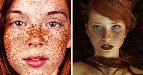 freckles are often found on people with fair complexions such as people with red hair why
