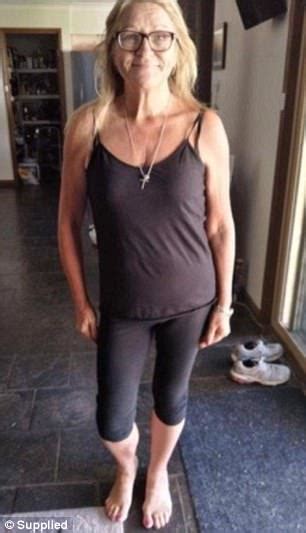 Nsw Grandmother Reveals Weight Loss Without Exercise Daily Mail Online