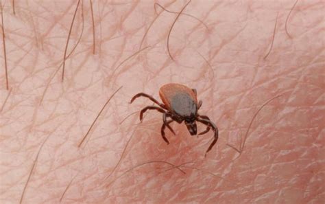 Tick Bites Symptoms Treatments Pictures And Prevention General Health Magazine