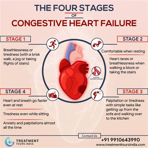 What Is Congestive Heart Failure Stages Causes Signs Symptoms Hot Sex