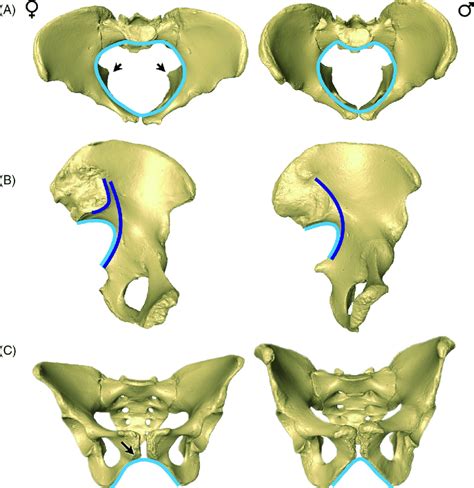 Sexually Dimorphic Traits Typically Observed In The Human Pelvis A