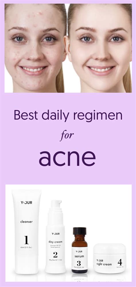Personalized Your Skin Are To Get The Best Daily Regimen For Acne Prone