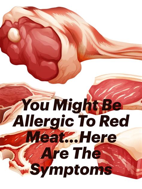 Pin On Alpha Gal Red Meat And Mammal Food Allergy