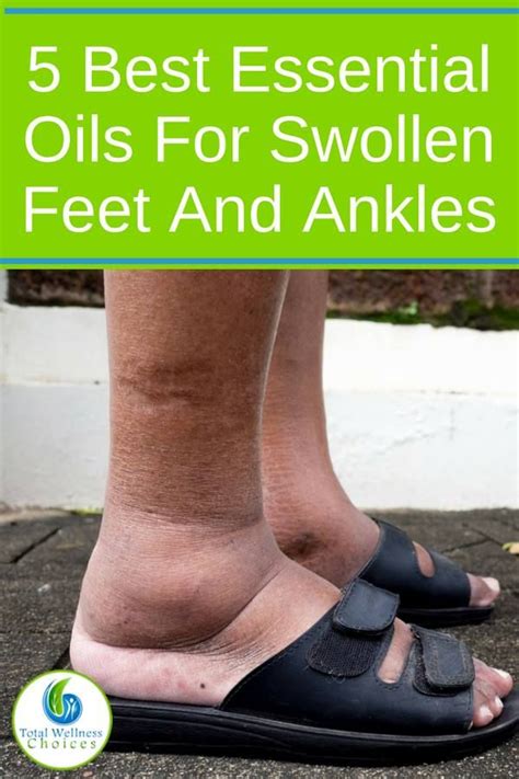 Top 5 Essential Oils For Swollen Feet And Ankles Essential Oils For
