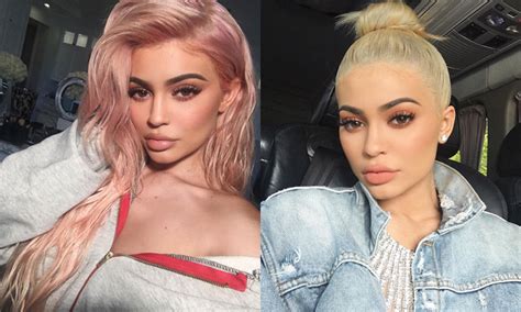 Kylie Jenner On Going Too Far With Lip Fillers And Why She Kept Them