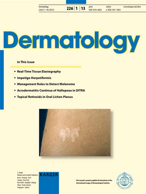 Acrodermatitis Continua Of Hallopeau Is A Clinical Phenotype Of Ditra