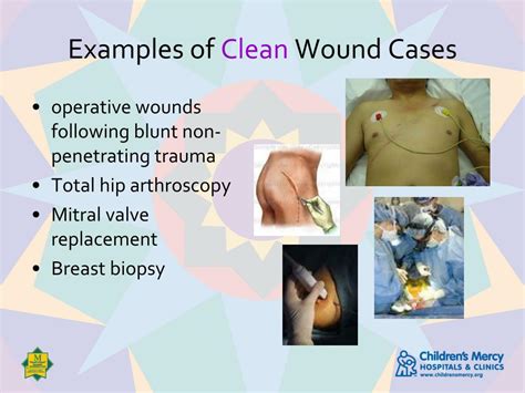 Ppt Wound Classification Powerpoint Presentation Free Download Id