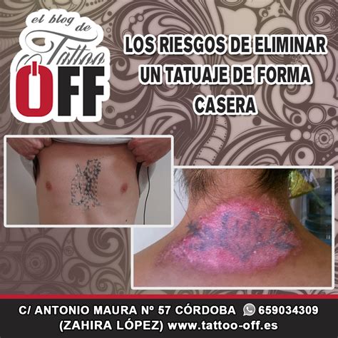 Riesgos De Eliminar De Forma Casera Un Tatuaje TATTOO OFF
