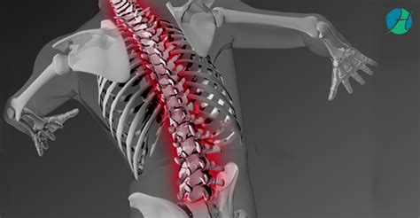 Injury Of Thoracic Spine Chiropractic Healthsoul