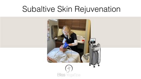 Sublative Skin Rejuvenation Youtube