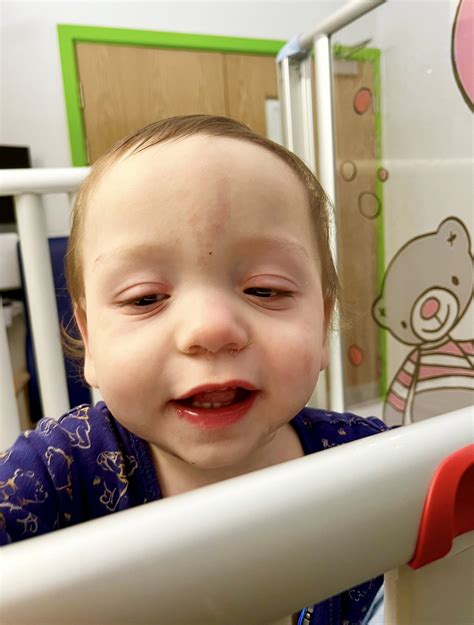 Woman Whose Baby Was Diagnosed With Rare Disease Warns Of ‘terrifying
