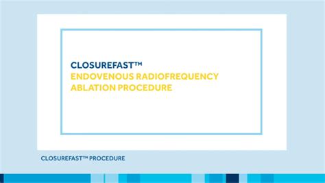 Radiofrequency Ablation Closurefast And Venclose Cvt