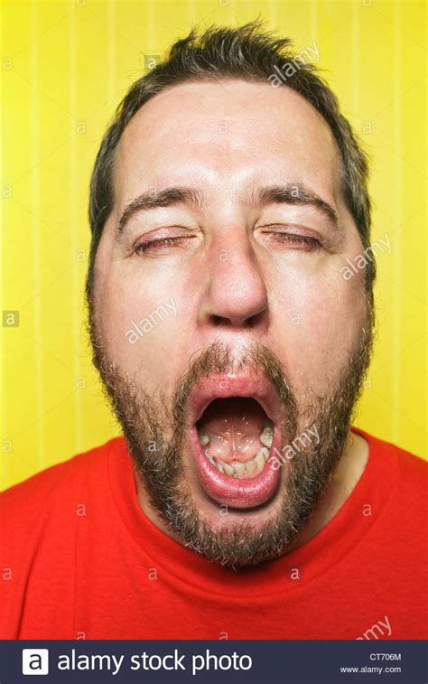 A Man 30s 40s Thirties Forties Yawning At The Camera With His