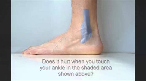 Lateral Malleolus Palpation Youtube