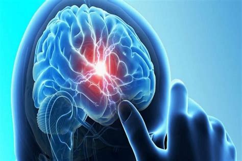 Are Brain Cancers On The Rise Brain Tumors In Children Symptoms