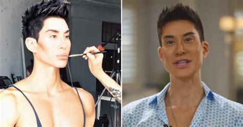 real life ken doll who spent half a million on transformations just got new back implants