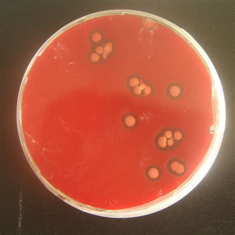 Beta Hemolysis Of Austwickia Chelonae On A Columbia Blood Agar Base