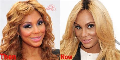 Tamar Braxton Plastic Surgery Before And After Pictures
