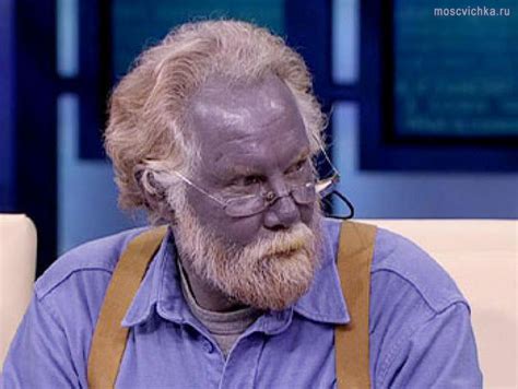 The Mystery Of Blue Skinned People