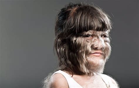 La Mujer Más Peluda Del Mundo Ha Mostrado Su Rostro Afeitado Por