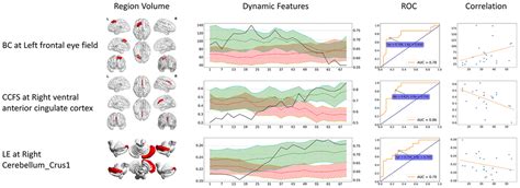 Abnormal Static And Dynamic Functional Connectivity Of Resting State