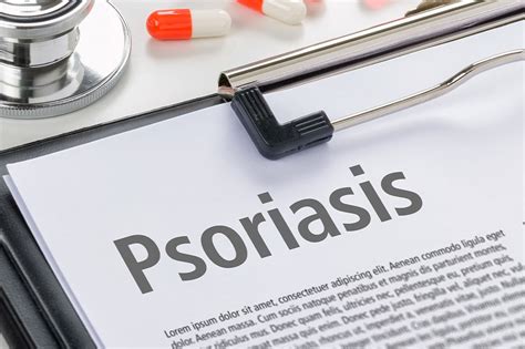 All You Need To Know About Plaque Psoriasis