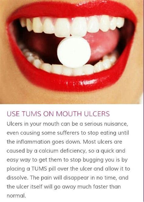 12 Natural Remedies For Mouth Sores That Work Sore In Mouth Remedies