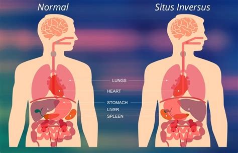 In the lower right side of the heart. What organs are on the right side of your back? - Quora