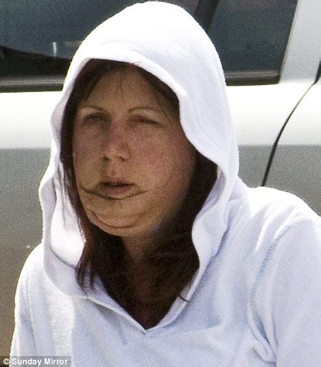 Road Rage Murderer Tracie Andrews Gets £5000 Of Plastic Surgery At